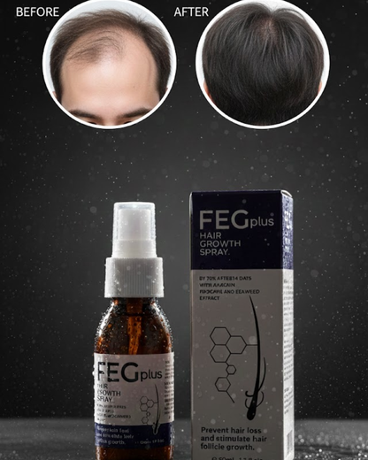 💇‍♂️ FEG Plus Hair Growth Spray – 50ml with Anagain & Seaweed 🌿