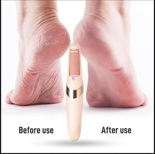 👣 Electric Rechargeable Callus Remover – Pedicure Foot File 💅